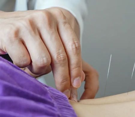 Exercício profissional da acupuntura é regulamentado no Brasil&nbsp;