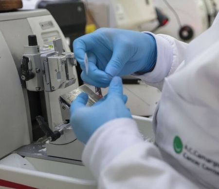 Tratado no início, cura de câncer de próstata pode chegar a até 98% Tratado no início, cura de câncer de próstata pode chegar a até 98%