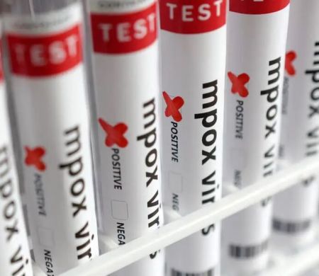 Mpox avança e acende alerta após 88 casos confirmados em 2026