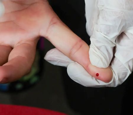 SUS inclui teste rápido de dengue para agilizar diagnósticos&nbsp;