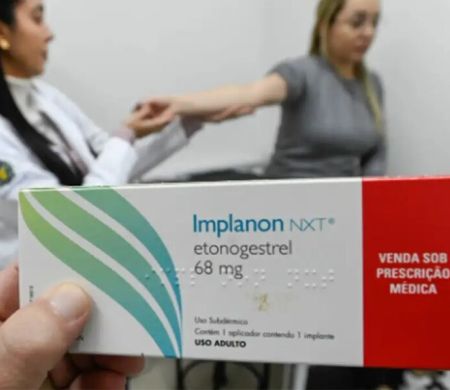 SUS treina equipes para ampliar implantes hormonais&nbsp;